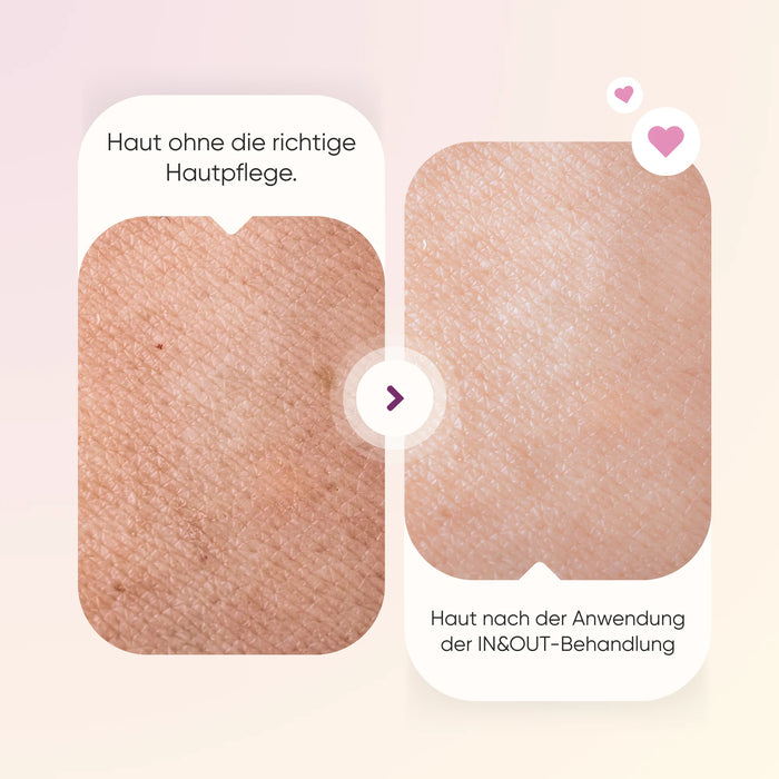 Sommer-Set In & Out | Make-up-Entferner + Anti-Falten-Serum + Moringa-Gesichtscreme + Kollagen-Kapseln