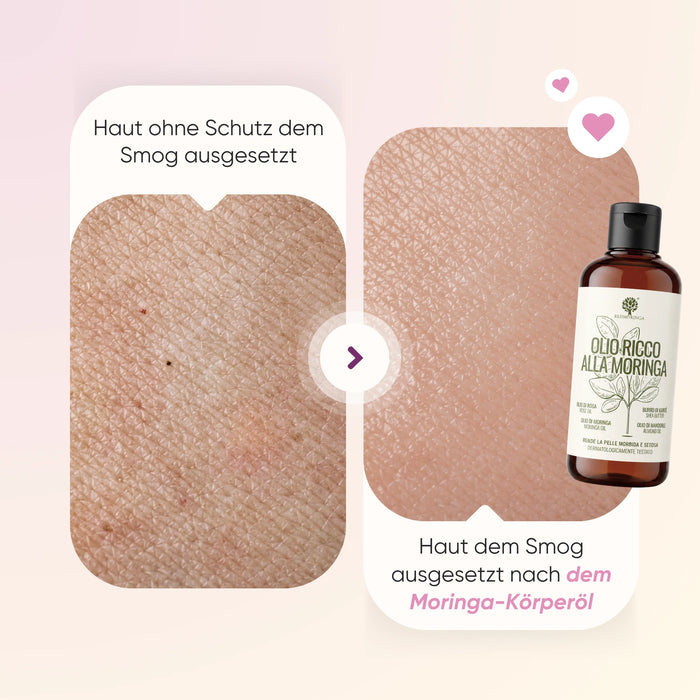 Sommer-Kit Anti-Cellulite | Nahrungserganzung + Korperol + Moringlow + Strandtasche