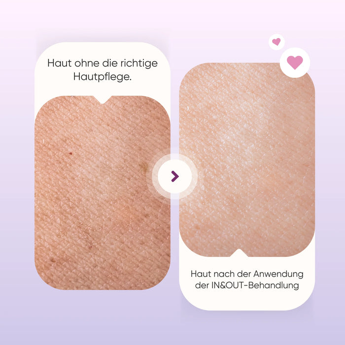 IN & OUT Gesichtsset mit Moringa | Kollagen-Kapseln + Gesichtscreme + Anti-Falten-Serum | Geschenkbox gratis